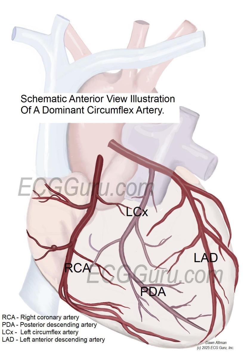 Dominant LCx Anterior View Dominant LCx