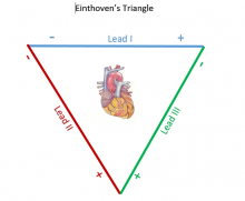 Einthoven's Triangle | ECG Guru - Instructor Resources