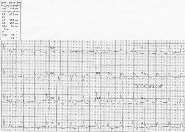 LPFB | ECG Guru - Instructor Resources