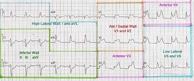 Do You Teach Basic Or Beginner Classes Ecg Guru Instructor Resources